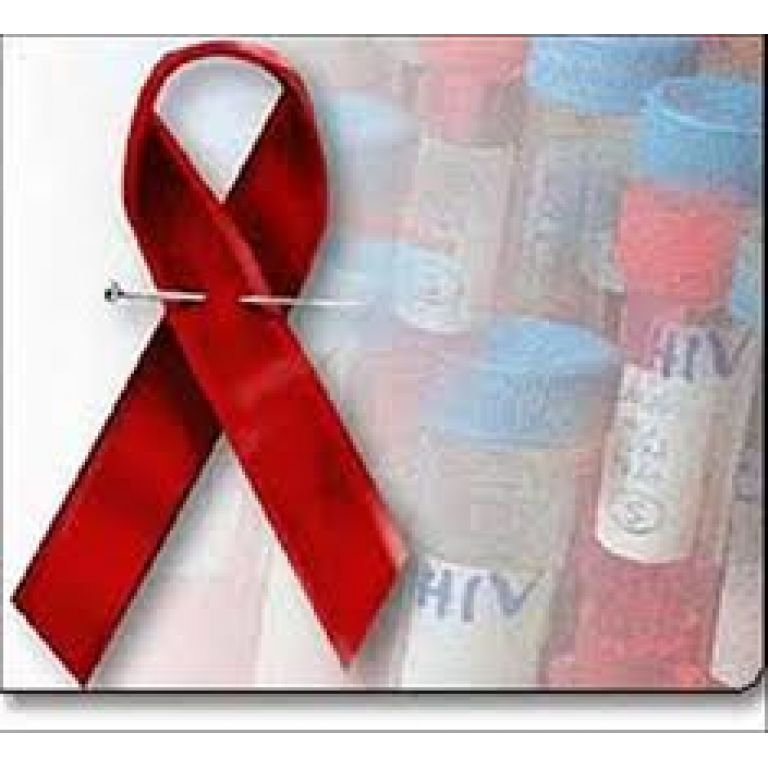 España: Desarrollan un test de diagnóstico preciso para el tratamiento del VIH