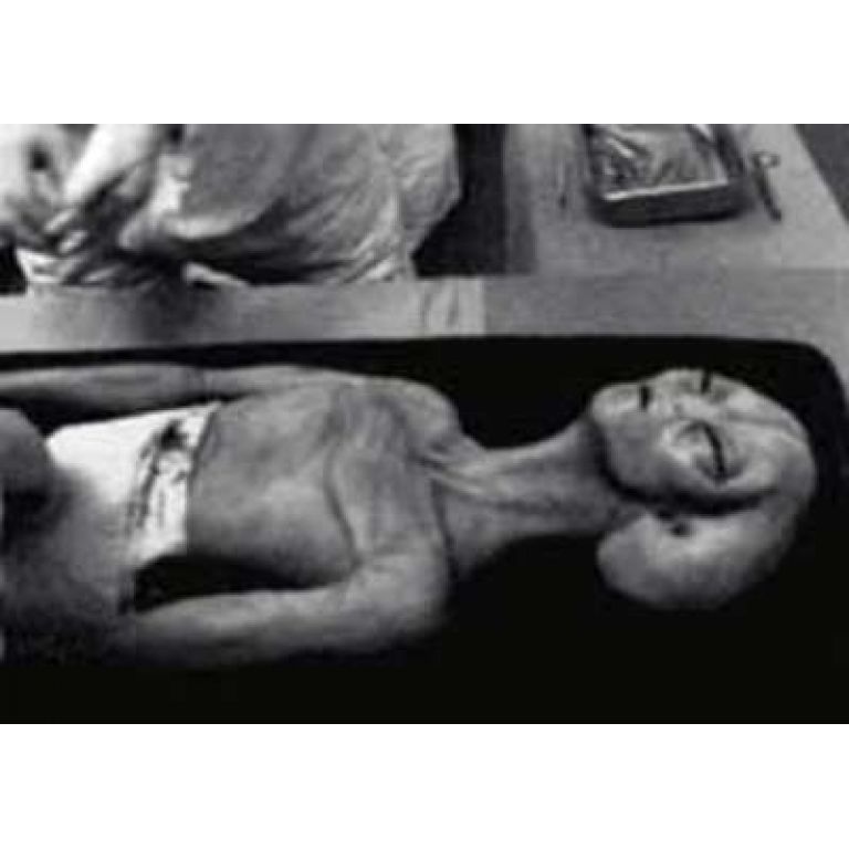 Fotografía de una autopsia a un ser extraterrestre