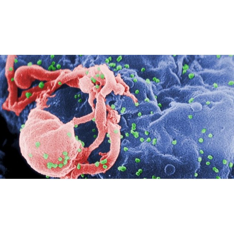Científicos desarrollan técnica que desactiva el VIH en el organismo